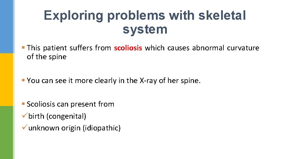 Exploring problems with skeletal system § This patient suffers from scoliosis which causes abnormal