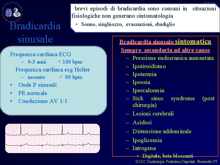 brevi episodi di bradicardia sono comuni in situazioni fisiologiche non generano sintomatologia Bradicardia sinusale