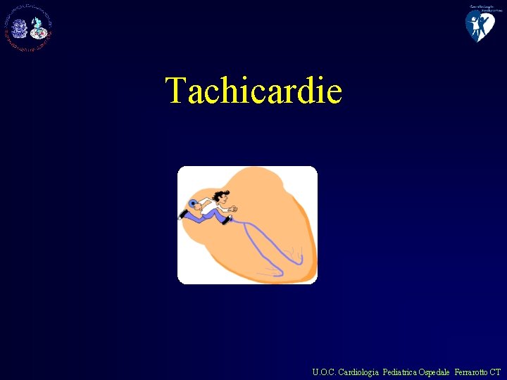 Tachicardie U. O. C. Cardiologia Pediatrica Ospedale Ferrarotto CT 