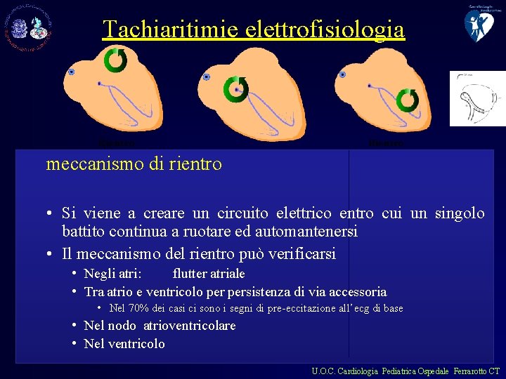 Tachiaritimie elettrofisiologia meccanismo di rientro • Si viene a creare un circuito elettrico entro