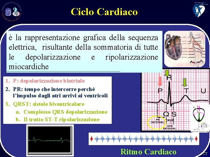 Ciclo Cardiaco è la rappresentazione grafica della sequenza elettrica, risultante della sommatoria di tutte