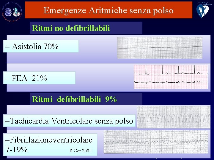 Emergenze Aritmiche senza polso Ritmi no defibrillabili – Asistolia 70% – PEA 21% Ritmi