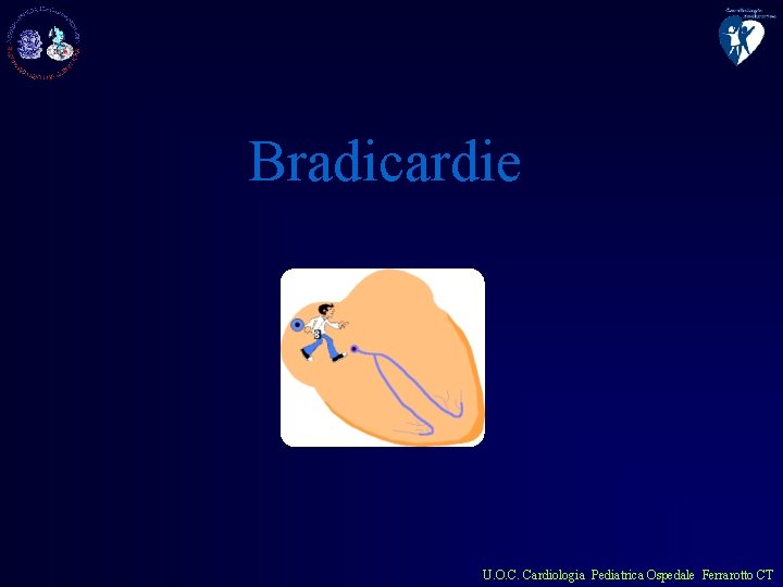 Bradicardie U. O. C. Cardiologia Pediatrica Ospedale Ferrarotto CT 
