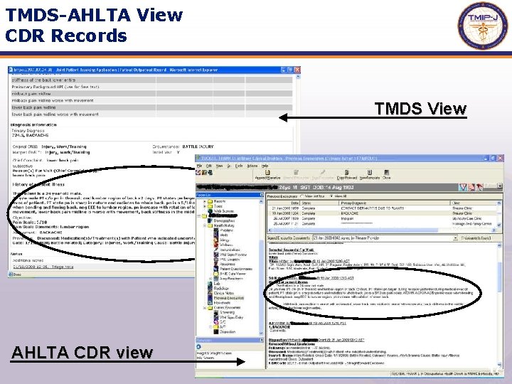 TMDS-AHLTA View CDR Records TMDS View AHLTA CDR view 17 