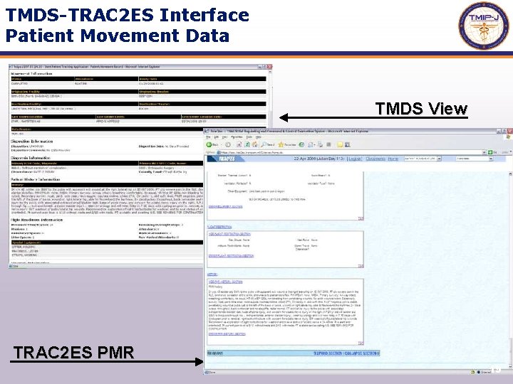 TMDS-TRAC 2 ES Interface Patient Movement Data TMDS View TRAC 2 ES PMR 19