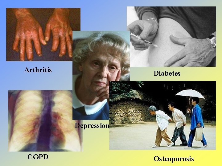 Arthritis Diabetes Depression COPD Osteoporosis 