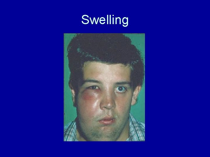 Swelling 