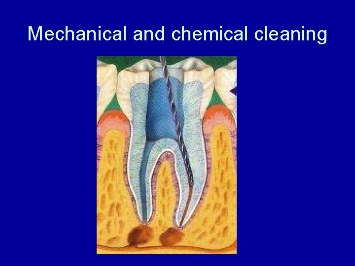 Mechanical and chemical cleaning 