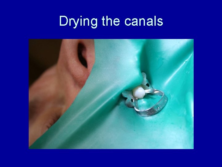 Drying the canals 