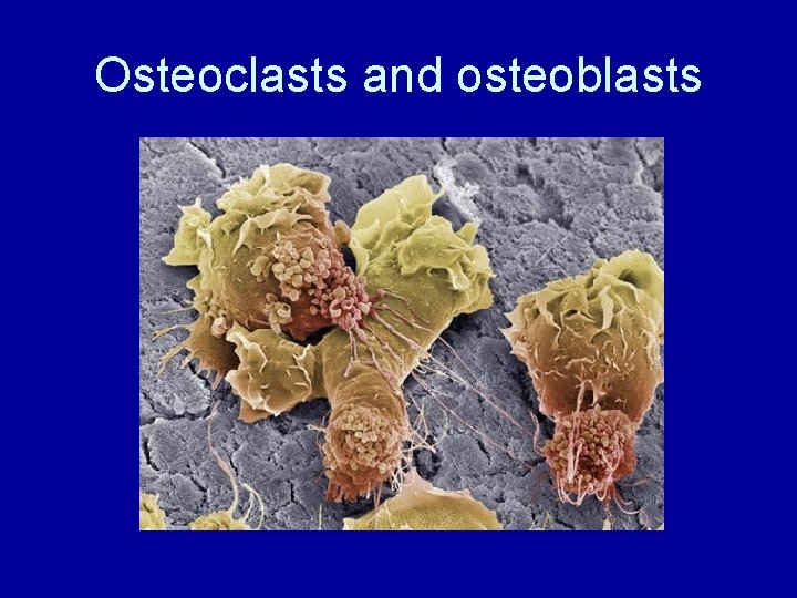 Osteoclasts and osteoblasts 