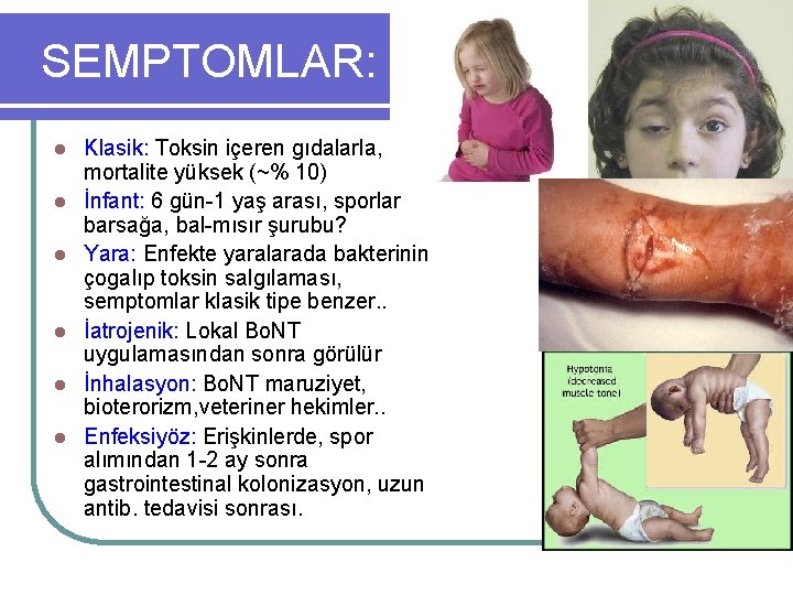 SEMPTOMLAR: l l l Klasik: Toksin içeren gıdalarla, mortalite yüksek (~% 10) İnfant: 6