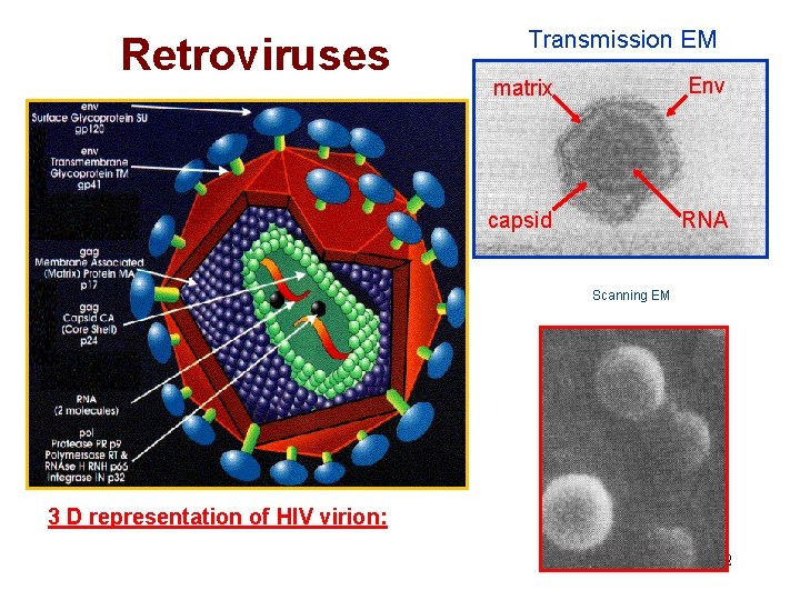 Retroviruses Transmission EM matrix Env capsid RNA Scanning EM 3 D representation of HIV