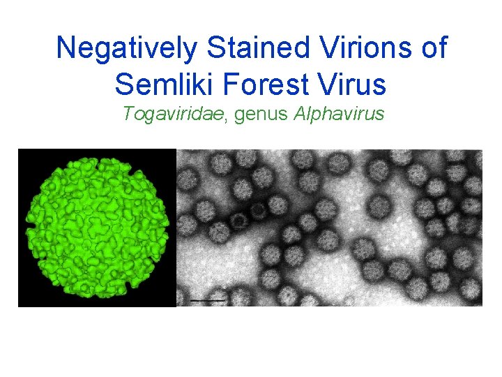 Negatively Stained Virions of Semliki Forest Virus Togaviridae, genus Alphavirus 