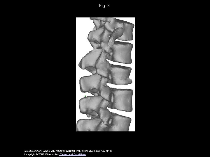 Fig. 3 Anesthesiology Clinics 2007 25913 -928 DOI: (10. 1016/j. anclin. 2007. 011) Copyright