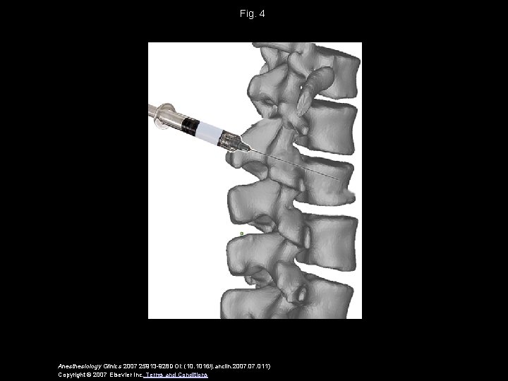 Fig. 4 Anesthesiology Clinics 2007 25913 -928 DOI: (10. 1016/j. anclin. 2007. 011) Copyright