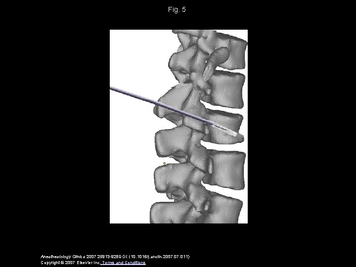 Fig. 5 Anesthesiology Clinics 2007 25913 -928 DOI: (10. 1016/j. anclin. 2007. 011) Copyright