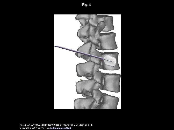 Fig. 6 Anesthesiology Clinics 2007 25913 -928 DOI: (10. 1016/j. anclin. 2007. 011) Copyright