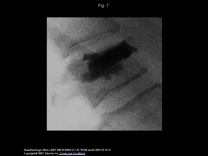 Fig. 7 Anesthesiology Clinics 2007 25913 -928 DOI: (10. 1016/j. anclin. 2007. 011) Copyright