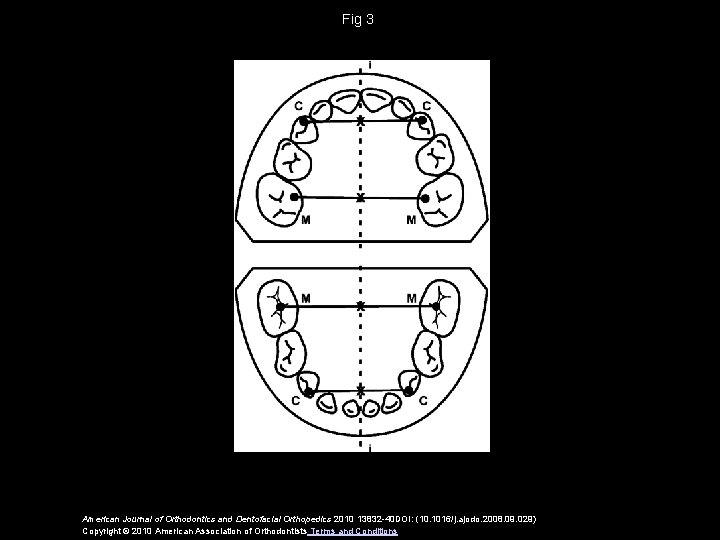 Fig 3 American Journal of Orthodontics and Dentofacial Orthopedics 2010 13832 -40 DOI: (10.