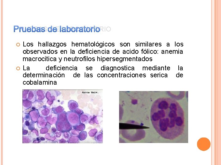 PRUEBAS DE LABORATORIO Los hallazgos hematológicos son similares a los observados en la deficiencia