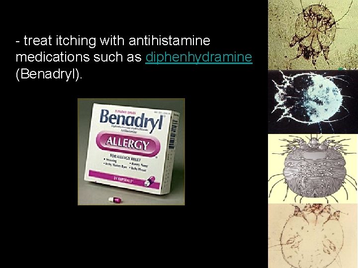 - treat itching with antihistamine medications such as diphenhydramine (Benadryl). 