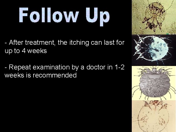 - After treatment, the itching can last for up to 4 weeks - Repeat