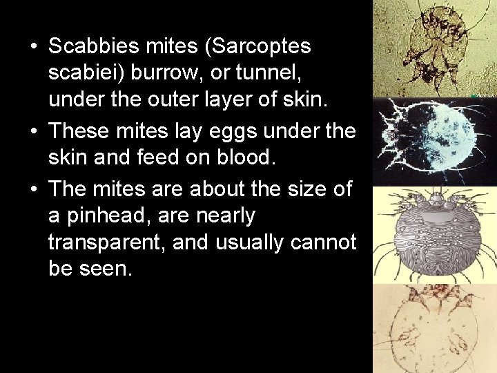  • Scabbies mites (Sarcoptes scabiei) burrow, or tunnel, under the outer layer of