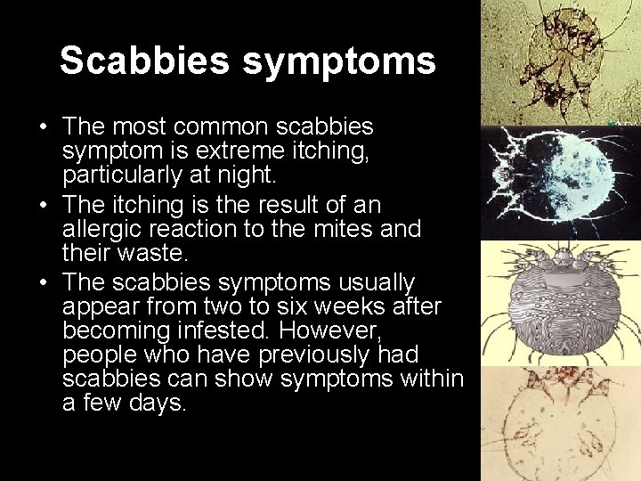 Scabbies symptoms • The most common scabbies symptom is extreme itching, particularly at night.