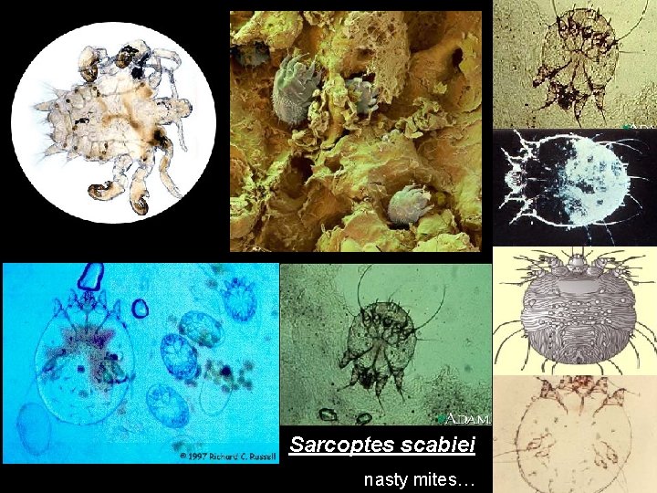 Sarcoptes scabiei nasty mites… 