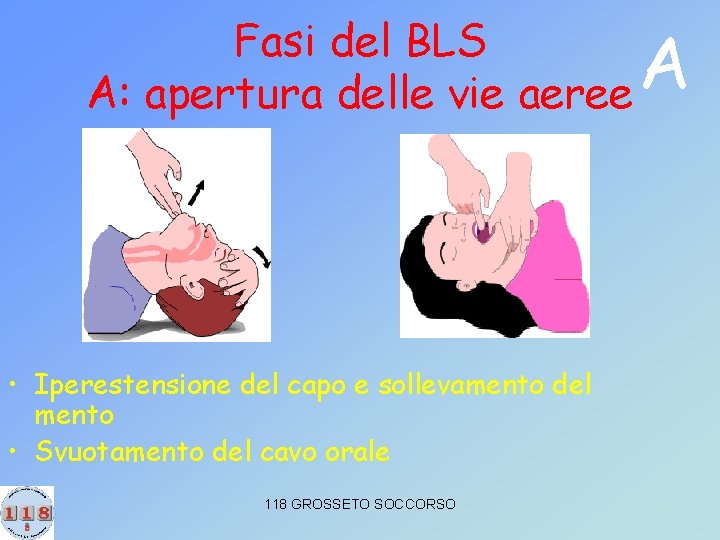 Fasi del BLS A: apertura delle vie aeree • Iperestensione del capo e sollevamento