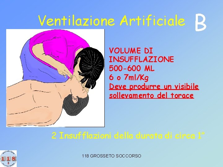 Ventilazione Artificiale B VOLUME DI INSUFFLAZIONE 500 -600 ML 6 o 7 ml/Kg Deve