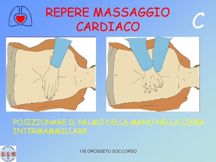 REPERE MASSAGGIO CARDIACO C POSIZIONARE IL PALMO DELLA MANO NELLA LINEA INTERMAMMILLARE 118 GROSSETO