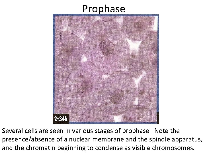  Prophase Several cells are seen in various stages of prophase. Note the presence/absence