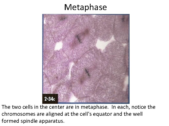  Metaphase The two cells in the center are in metaphase. In each, notice