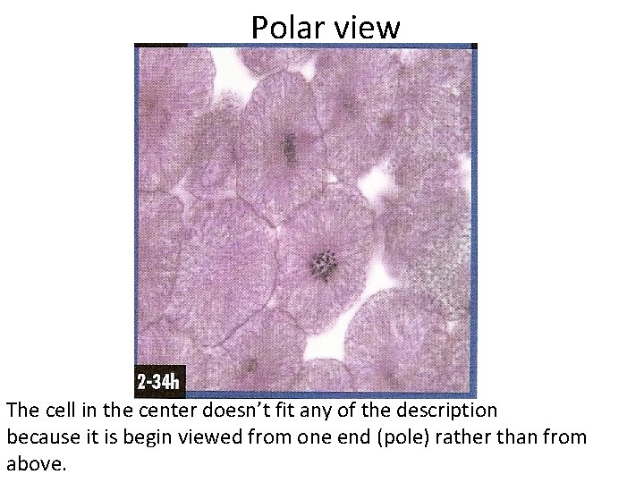  Polar view The cell in the center doesn’t fit any of the description