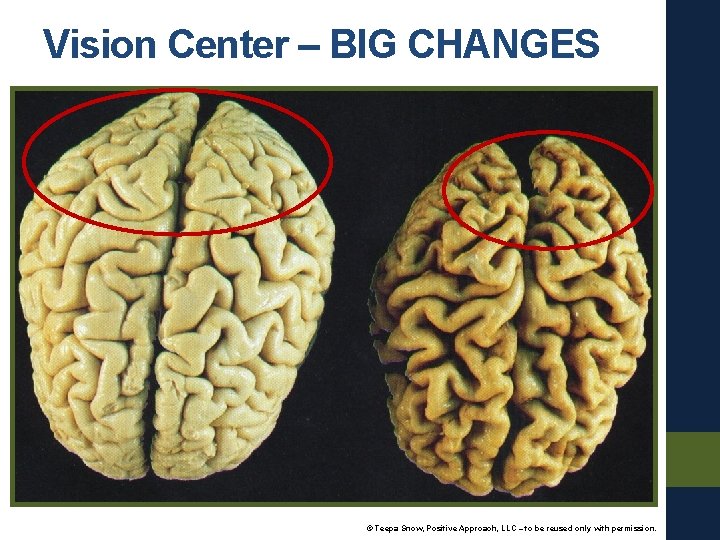Vision Center – BIG CHANGES © Teepa Snow, Positive Approach, LLC – to be