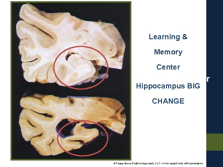 Learning & Memory Center Hippocampus BIG Hippocampus CHANGE BIG CHANGE © Teepa Snow, Positive