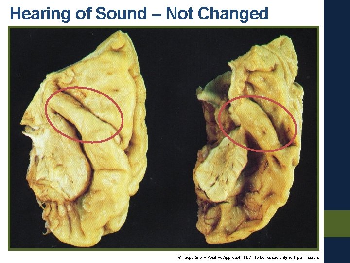 Hearing of Sound – Not Changed © Teepa Snow, Positive Approach, LLC – to