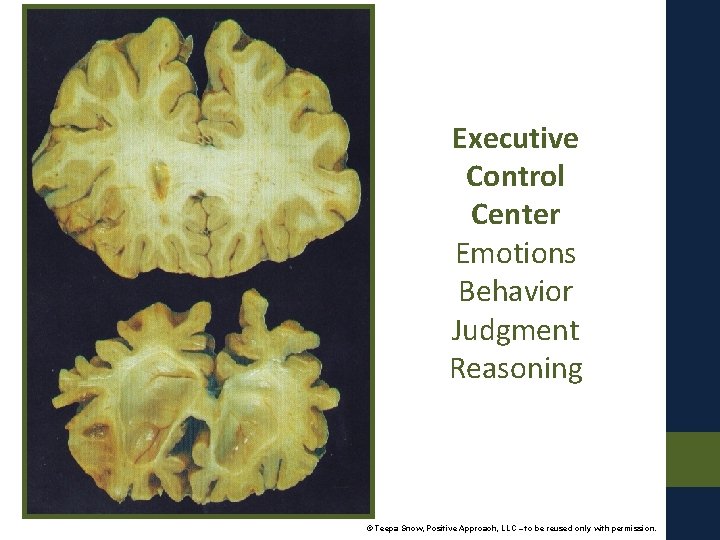 Executive Control Center Emotions Behavior Judgment Reasoning © Teepa Snow, Positive Approach, LLC –