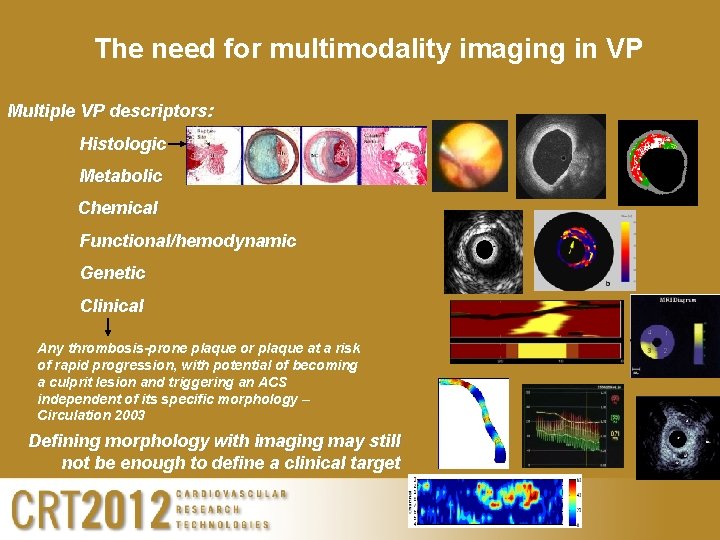 The need for multimodality imaging in VP Multiple VP descriptors: Histologic Metabolic Chemical Functional/hemodynamic