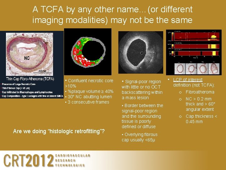 A TCFA by any other name…(or different imaging modalities) may not be the same