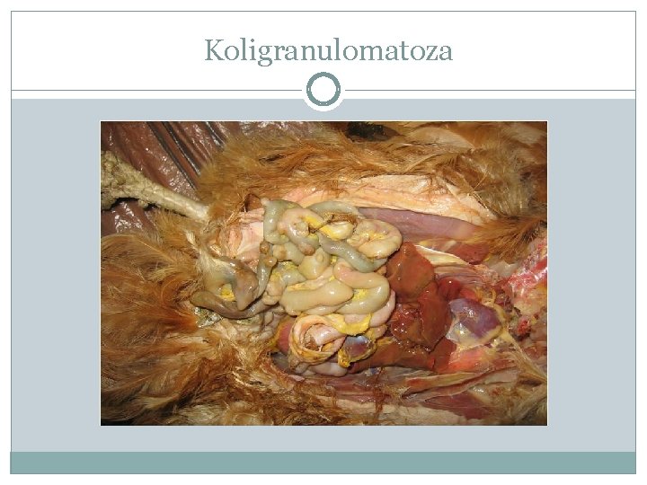 Koligranulomatoza 