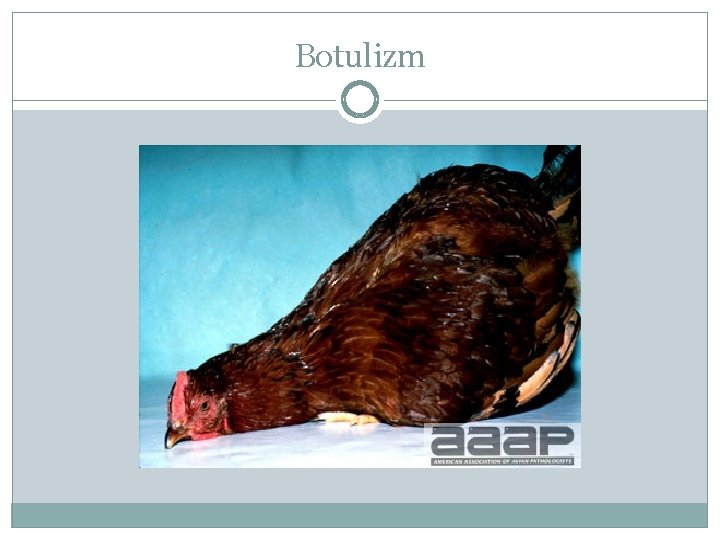 Botulizm 