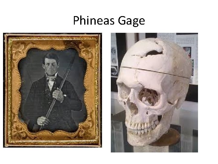 Phineas Gage 
