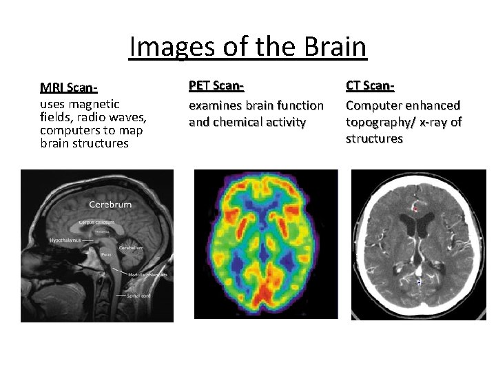 Images of the Brain MRI Scanuses magnetic fields, radio waves, computers to map brain