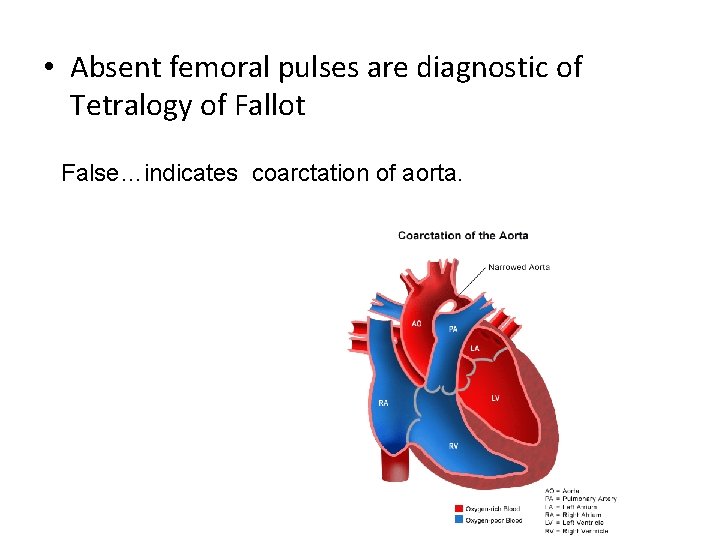  • Absent femoral pulses are diagnostic of Tetralogy of Fallot False…indicates coarctation of