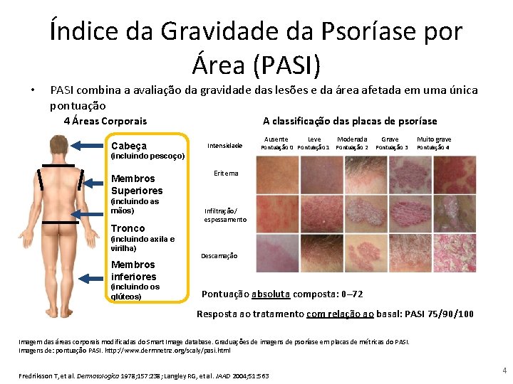 Índice da Gravidade da Psoríase por Área (PASI) • PASI combina a avaliação da