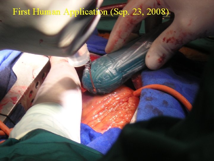 First Human Application (Sep. 23, 2008) 
