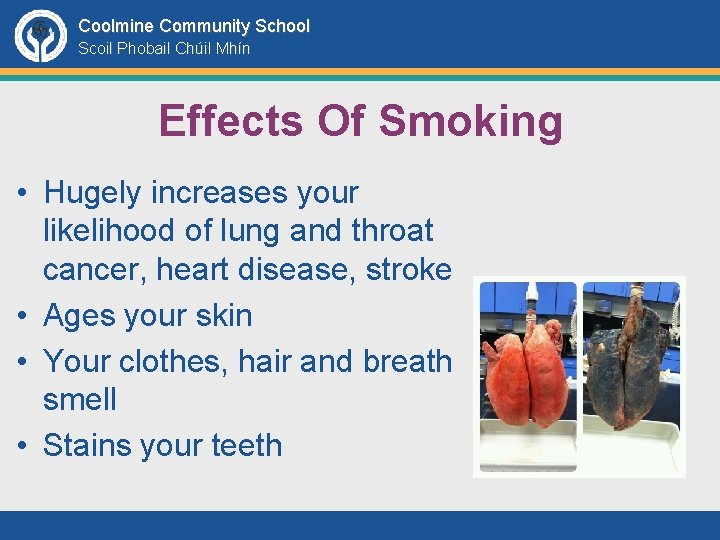 Coolmine Community School Scoil Phobail Chúil Mhín Effects Of Smoking • Hugely increases your