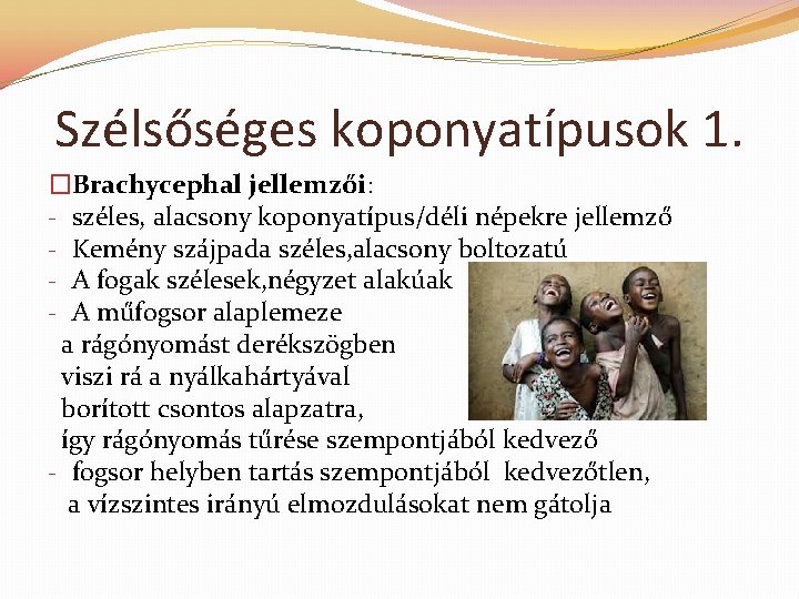 Szélsőséges koponyatípusok 1. �Brachycephal jellemzői: - széles, alacsony koponyatípus/déli népekre jellemző - Kemény szájpada